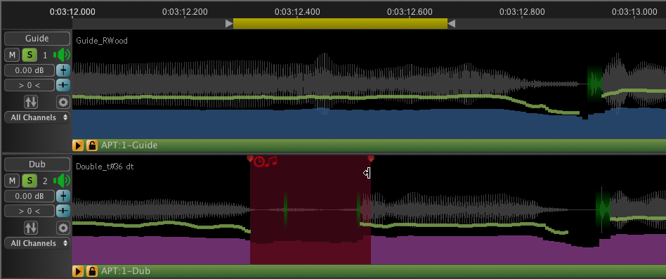 Add Protected Region at Breath